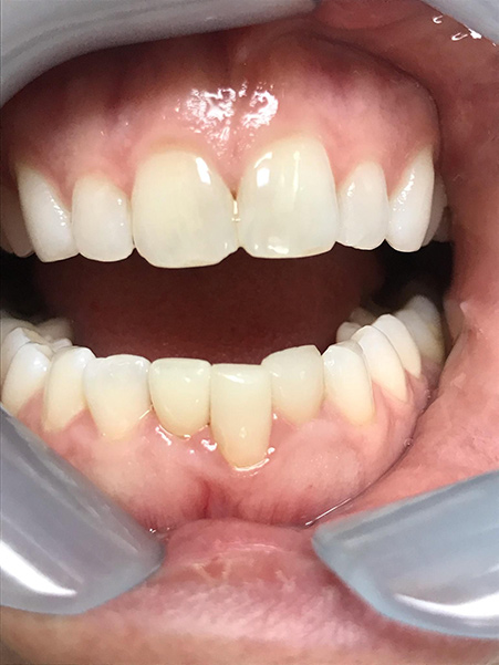 Holcroft Cosmetic & Family Dentistry Holcroft Cosmetic & Family Dentistry