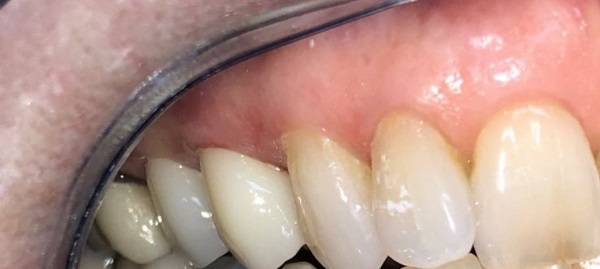 Holcroft Cosmetic & Family Dentistry Holcroft Cosmetic & Family Dentistry
