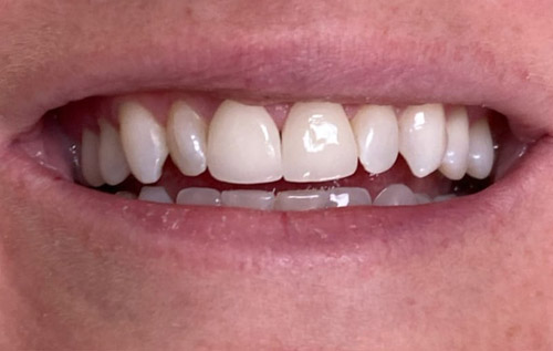 Holcroft Cosmetic & Family Dentistry Holcroft Cosmetic & Family Dentistry
