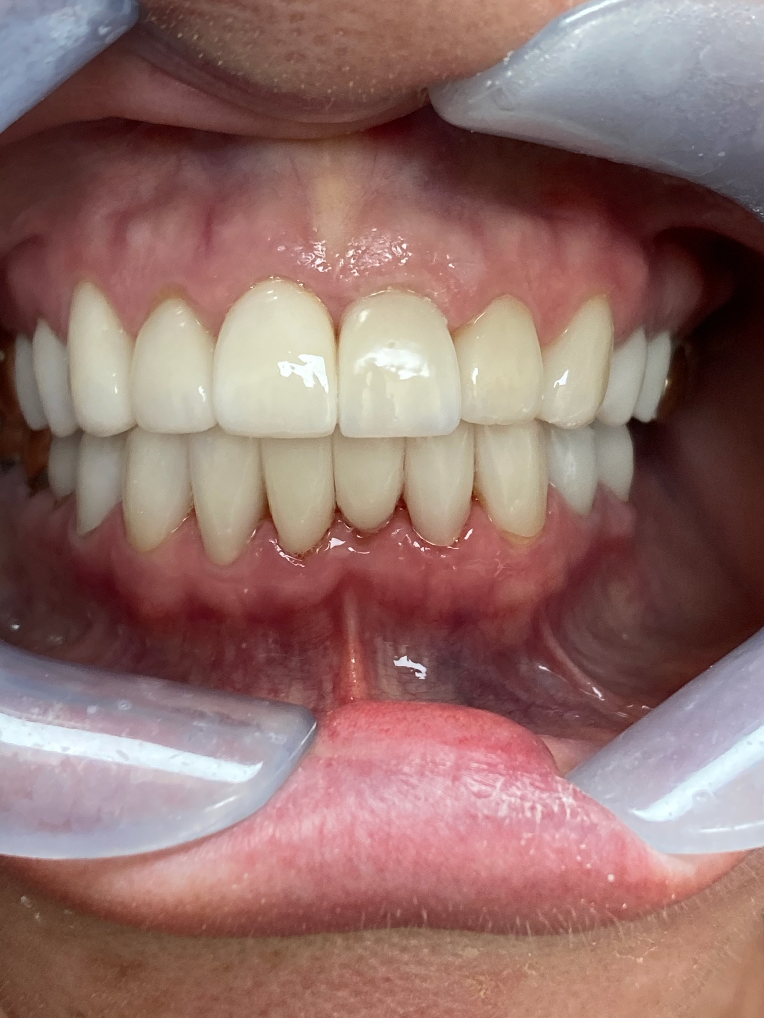 Holcroft Cosmetic & Family Dentistry Holcroft Cosmetic & Family Dentistry