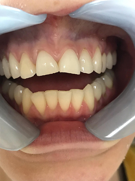 Holcroft Cosmetic & Family Dentistry Holcroft Cosmetic & Family Dentistry