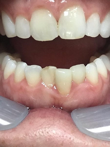 Holcroft Cosmetic & Family Dentistry Holcroft Cosmetic & Family Dentistry