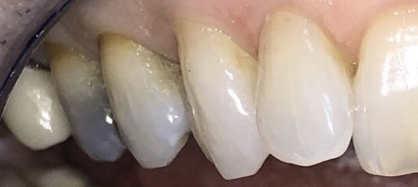 Holcroft Cosmetic & Family Dentistry Holcroft Cosmetic & Family Dentistry