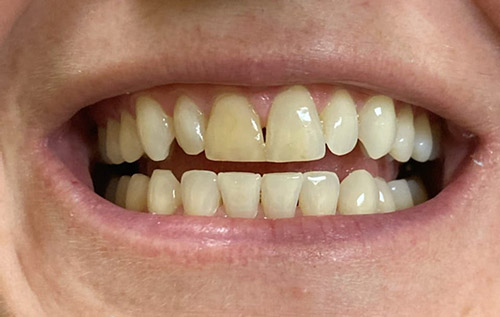Holcroft Cosmetic & Family Dentistry Holcroft Cosmetic & Family Dentistry