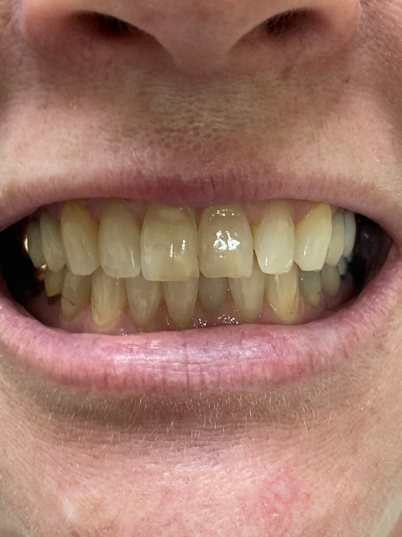 Holcroft Cosmetic & Family Dentistry Holcroft Cosmetic & Family Dentistry