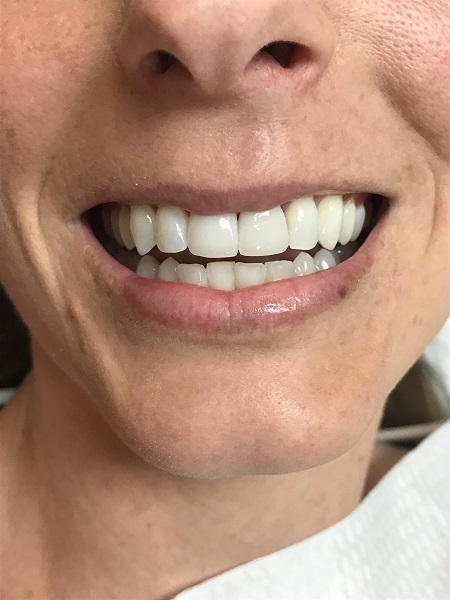 Holcroft Cosmetic & Family Dentistry Holcroft Cosmetic & Family Dentistry